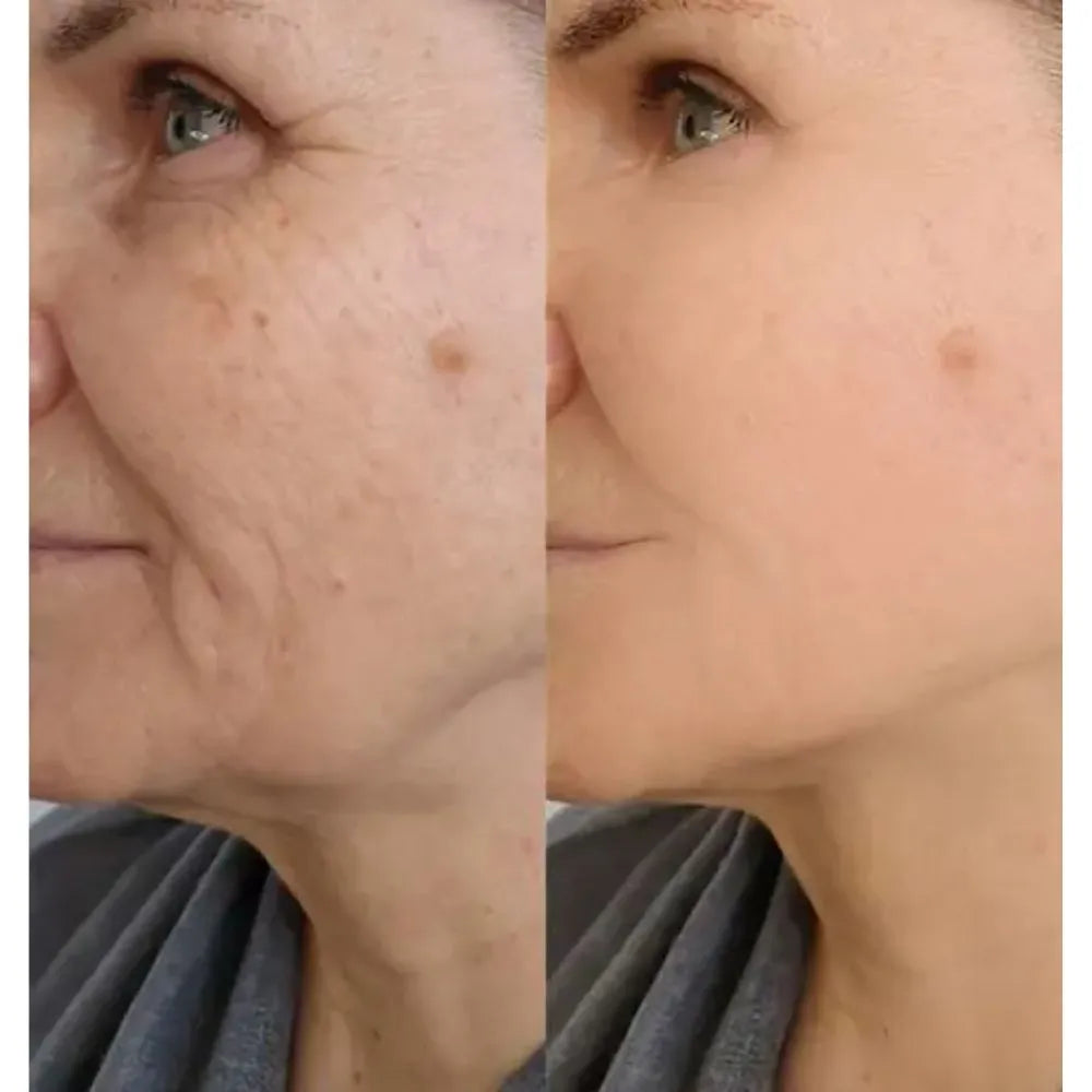 BeeVita Cream | Mejora tu piel dañada y recupera tu aspecto saludable sin químicos.