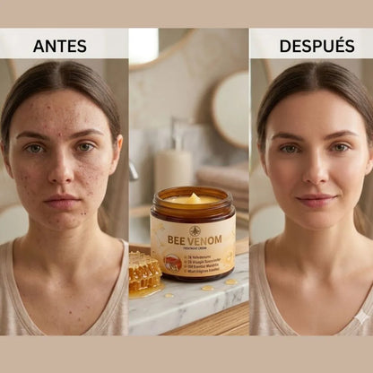 BeeVita Cream | Mejora tu piel dañada y recupera tu aspecto saludable sin químicos.