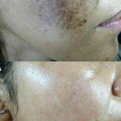 BeeVita Cream | Mejora tu piel dañada y recupera tu aspecto saludable sin químicos.
